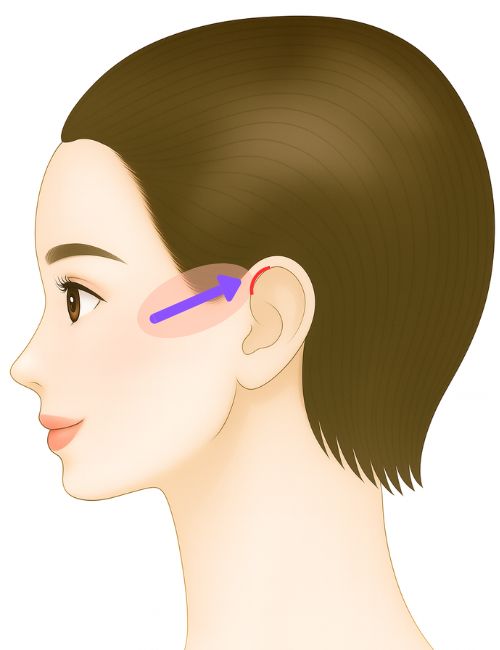 SMASフェイスリフト・スタンダード